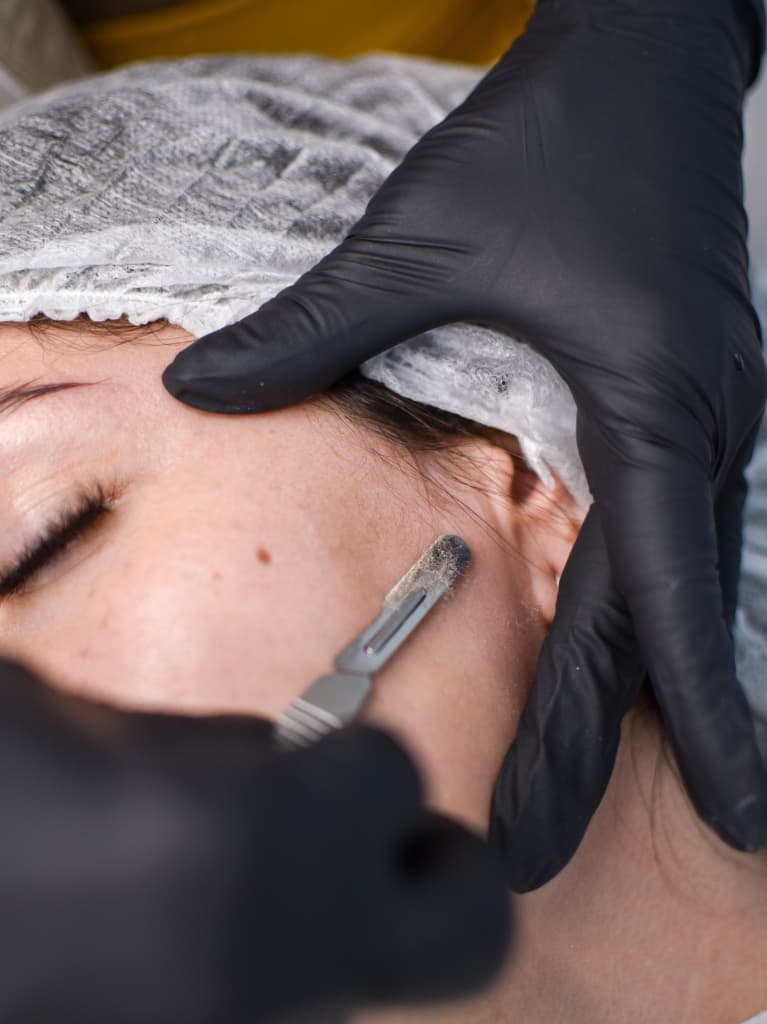 Dermaplaning Tratamiento facial Neuquén, Ammé Estética Boutique